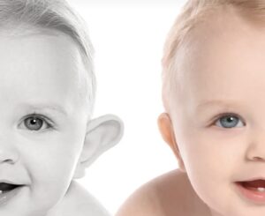 Flasteri za klempave uši za bebe, djecu i odrasle 20 kom